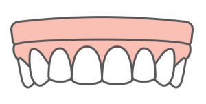 icon of snap in dentures